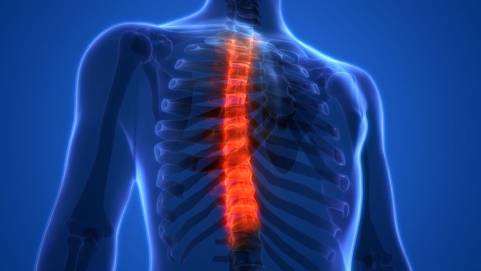osteochondroza kręgosłupa piersiowego