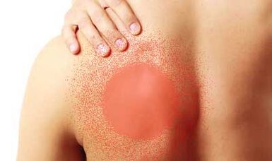 ból pod lewą łopatką